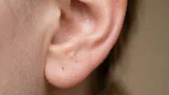 Zašto imamo toliko ušne masti? Istina koju ti nitko ne govori